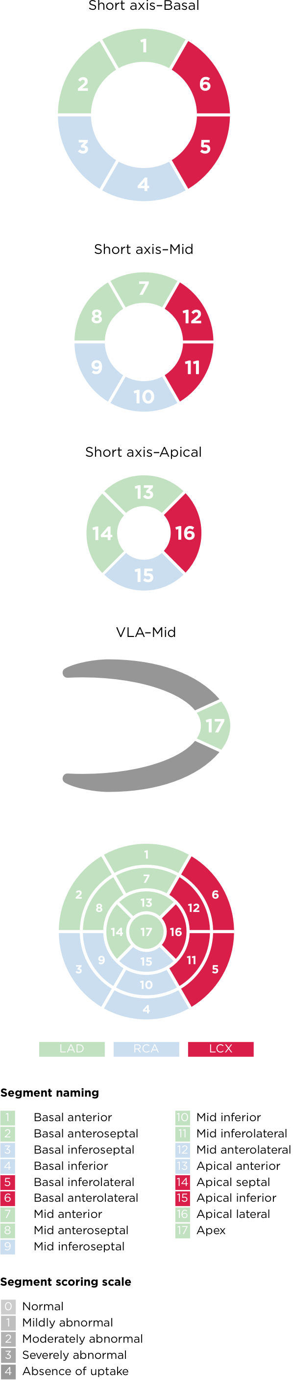 Left ventricular segmentation and scoring