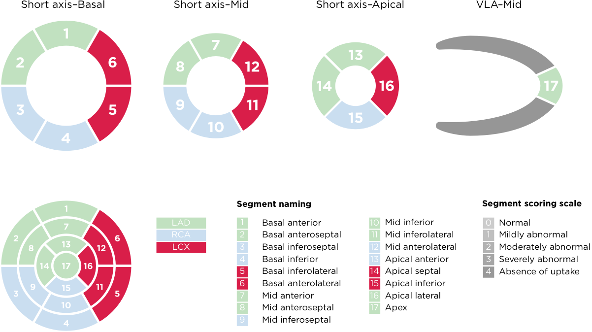 Left ventricular segmentation and scoring